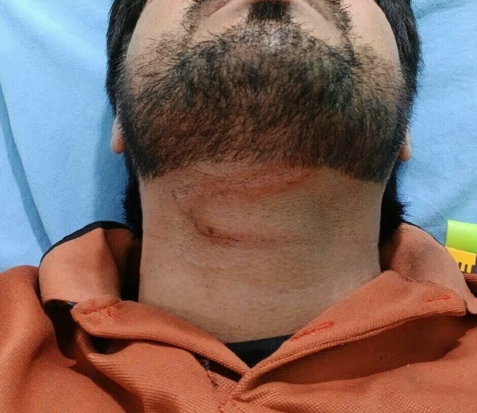Imagem de compartilhamento para o artigo Fio de internet derruba e enforca motoentregador em Chapadão do Sul da MS Todo dia